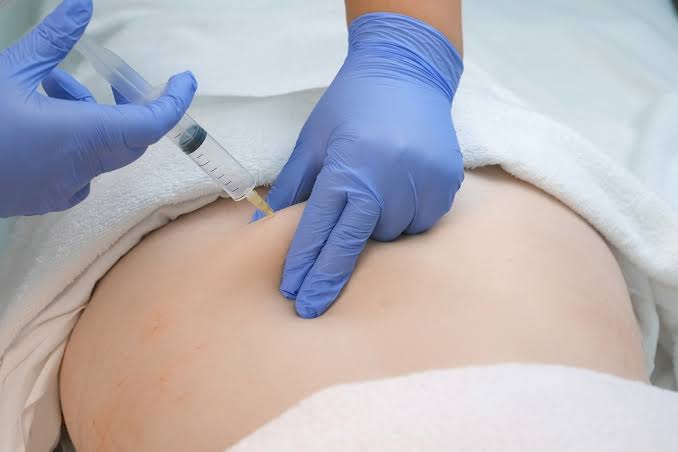 Ambulatorio di Ozonoterapia Lecce - Dr. Giacomo Melle